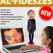 AlFideszes 01 1