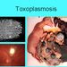 toxoplasmosis2