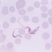 trypanosoma evansi